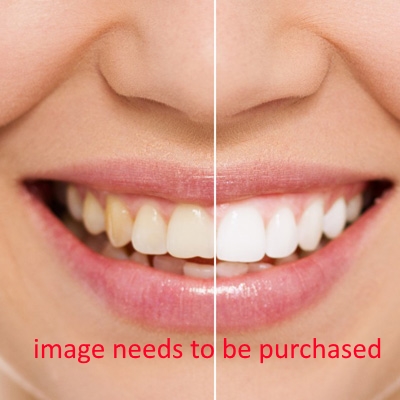 before-after-box