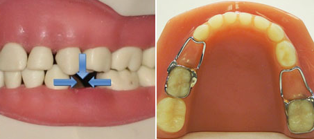 Care Dental Dentist In Hobbs Family Dentist Kids Dentist